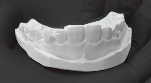 일반 치아 모형