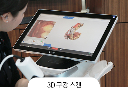 스캔