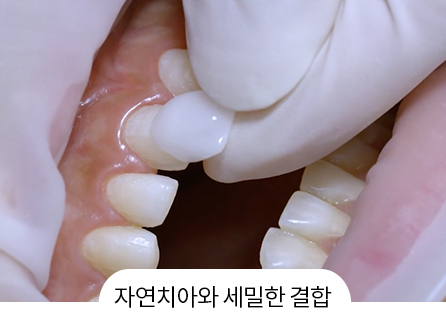 스캔