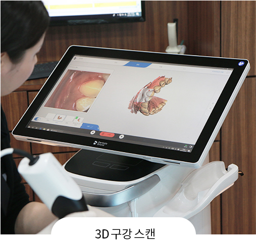 스캔