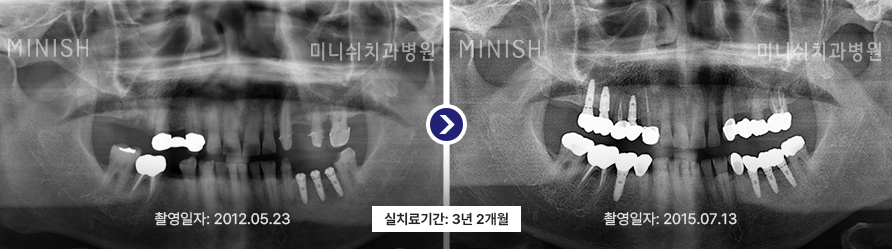 파노라마 1