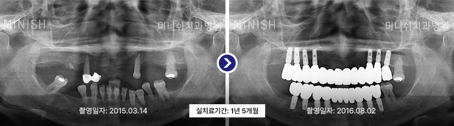 파노라마 2