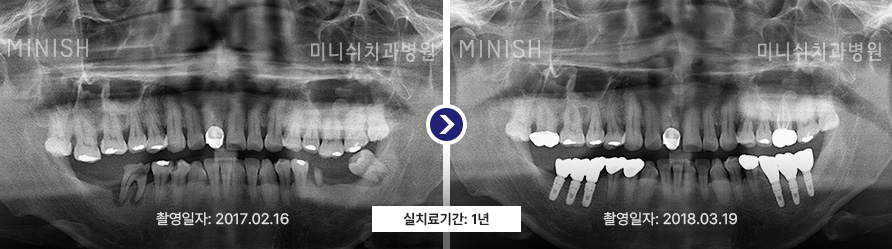 파노라마 3