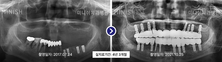 파노라마 4