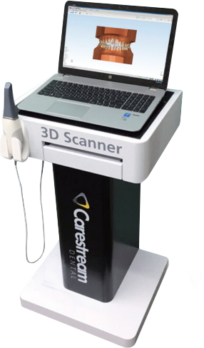 3D Scanner