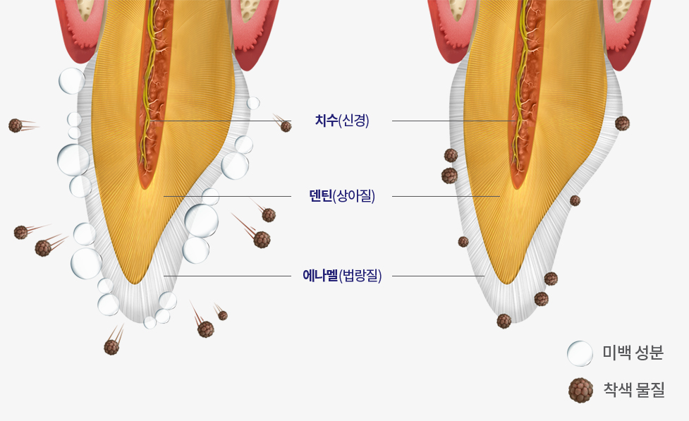 생활치 미백 원리